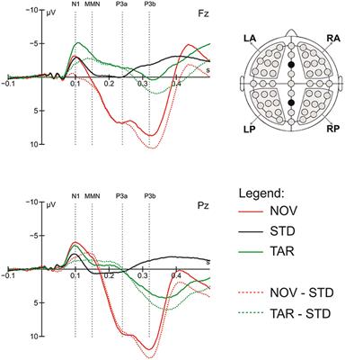 Human Novelty Response to Emotional Animal Vocalizations: Effects of Phylogeny and Familiarity